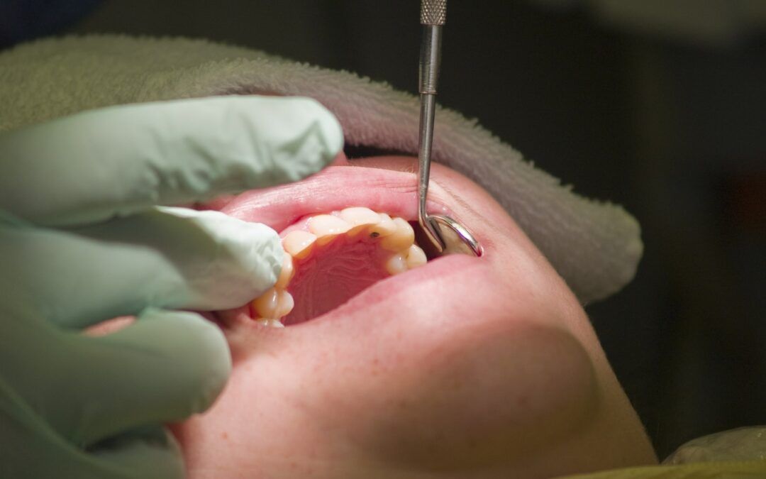 Surgical Endodontics What is it, Symptoms and Treatment » Los Angeles